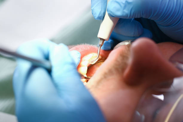 Best Cracked Tooth Emergency Dentist  in Kingsley, IA